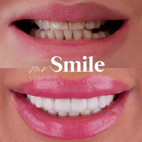 mrsmile_preview_one_and_unique_smile_best_dental_services_no1